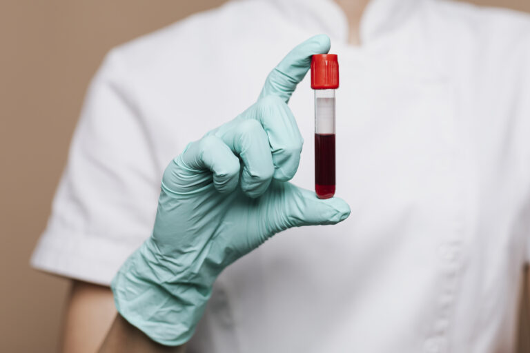 Common Types of Blood Tests, Types of Blood Tests