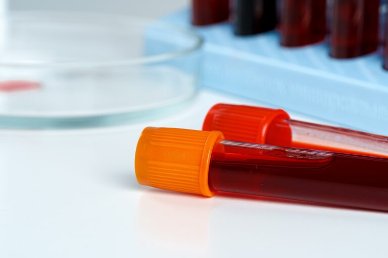 CBC (Complete Blood Count) Test vs. Other Blood Tests Understanding the Differences