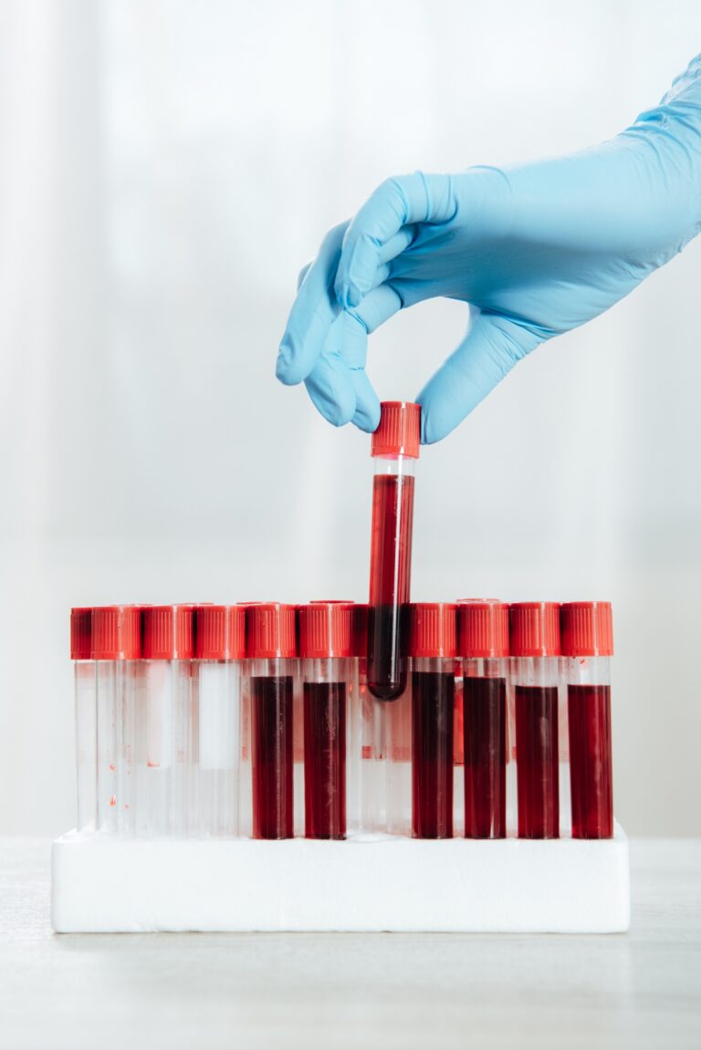 Blood Tests Near Me Blood Test at Home Your Convenient Path to Accurate and Reliable Results