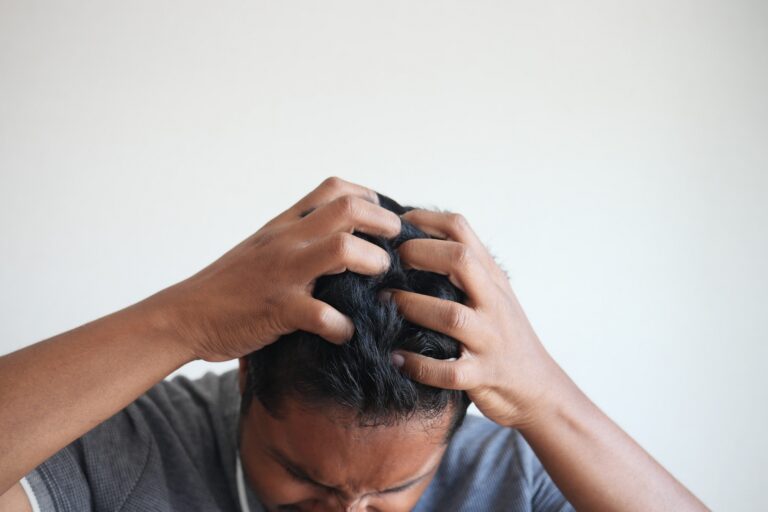 Home Remedies for Itchy Scalp, by mend.zone