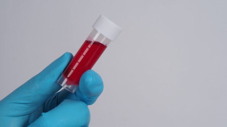 Blood Urea Nitrogen (BUN) Test Unlocking Vital Clues About Your Kidney Health, mend.zone