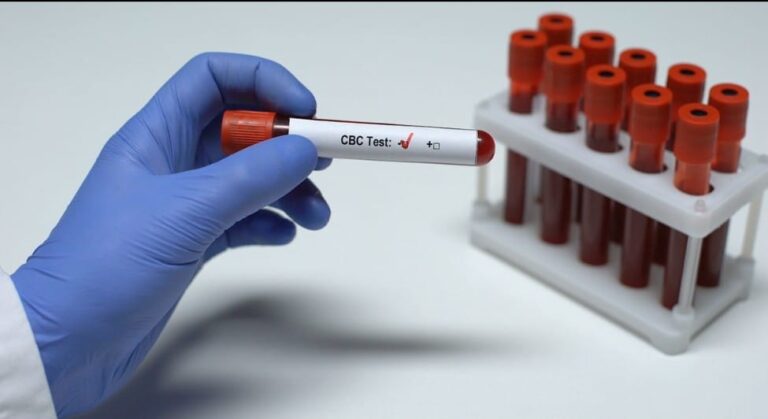 Complete Blood Count (CBC) Test At Home Your Comprehensive Guide by Mend.zone