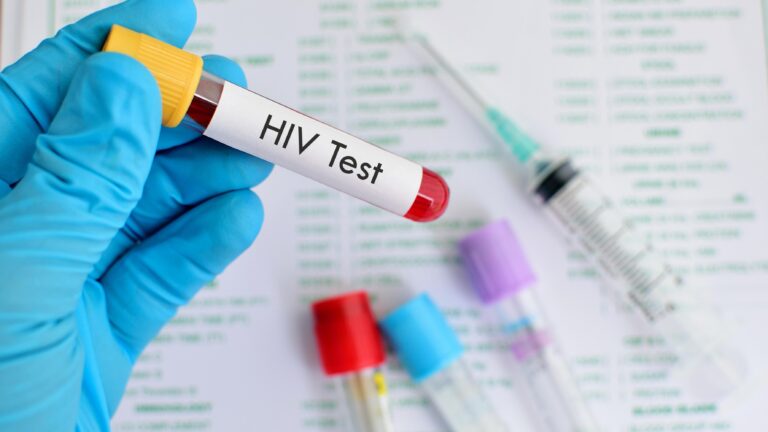 HIV Test at Home Empowering Your Health Journey