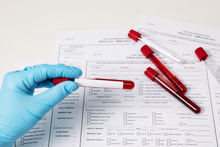 HbA1c (Glycated Hemoglobin) Blood Test At Home: A Comprehensive Guide to Convenient Diabetes Management by mend.zone