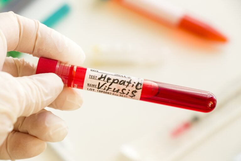 Hepatitis B and C Tests at Home Your Guide to Convenient and Confidential Screening