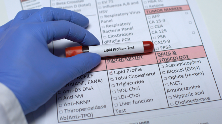 Lipid Profile Blood Test At Home Your Comprehensive Guide