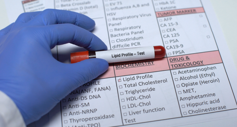 Lipid Profile Blood Test At Home Your Comprehensive Guide by mend.zone