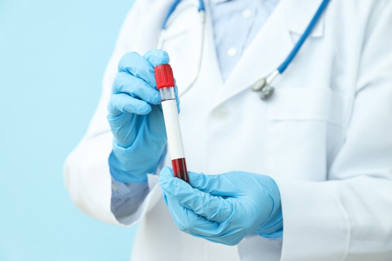 Lipid Profile (Cholesterol levels) Blood Test Near Me Lipid Profile (Cholesterol levels) Test At Home, mend.zone online health checkup and blood test booking platform