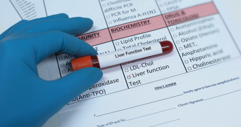 Liver Function Test (LFT) At Home