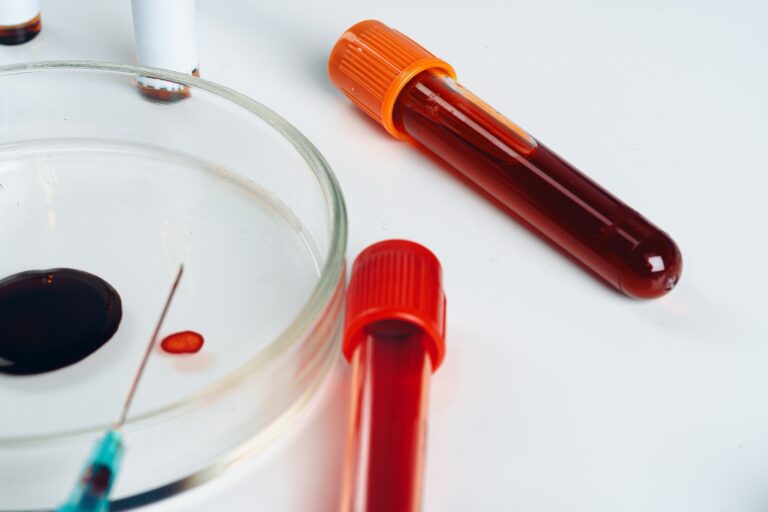 Thyroid Profile-Total (T3, T4 & TSH) Blood Test at Home Near me