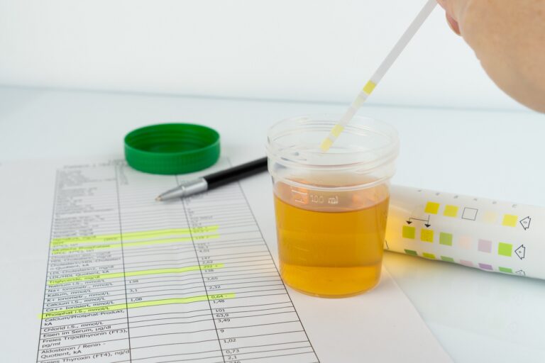 Urine Culture Test Unlocking the Secrets of Your Urinary Health