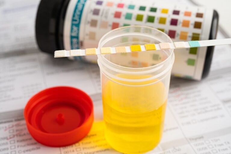 Urine Routine Examination Near Me Urine Routine Examination At Home, , mend.zone online health checkup and blood test booking platform