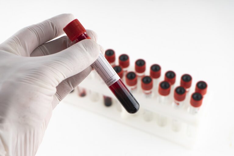 All Types of Blood Tests Can Be Done from Home A Comprehensive Guide