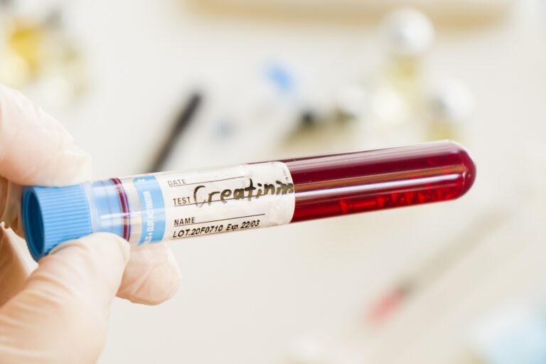 Demystifying the Creatinine Blood Test and Its Vital Role in Your Health. mend.zone