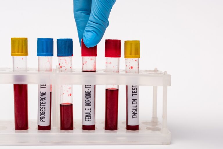 Mastering Your Blood Test Preparation A Stress-Free Guide