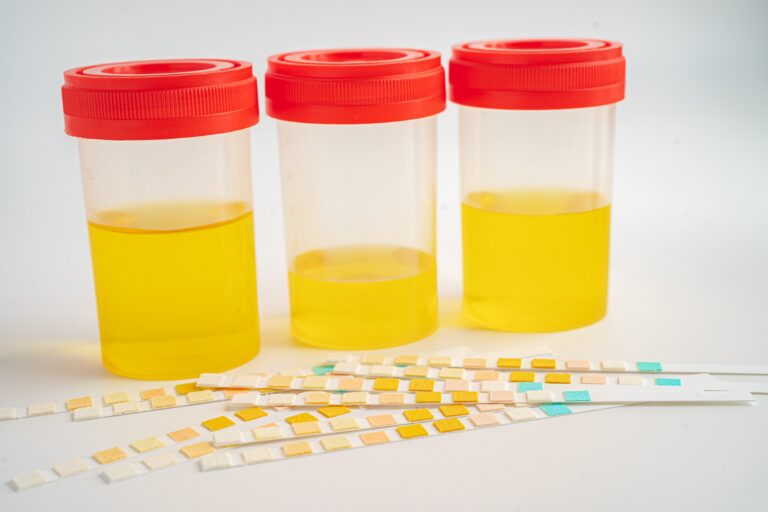 Urine Culture Test Deciphering the Messages in Your Urine, mendzone